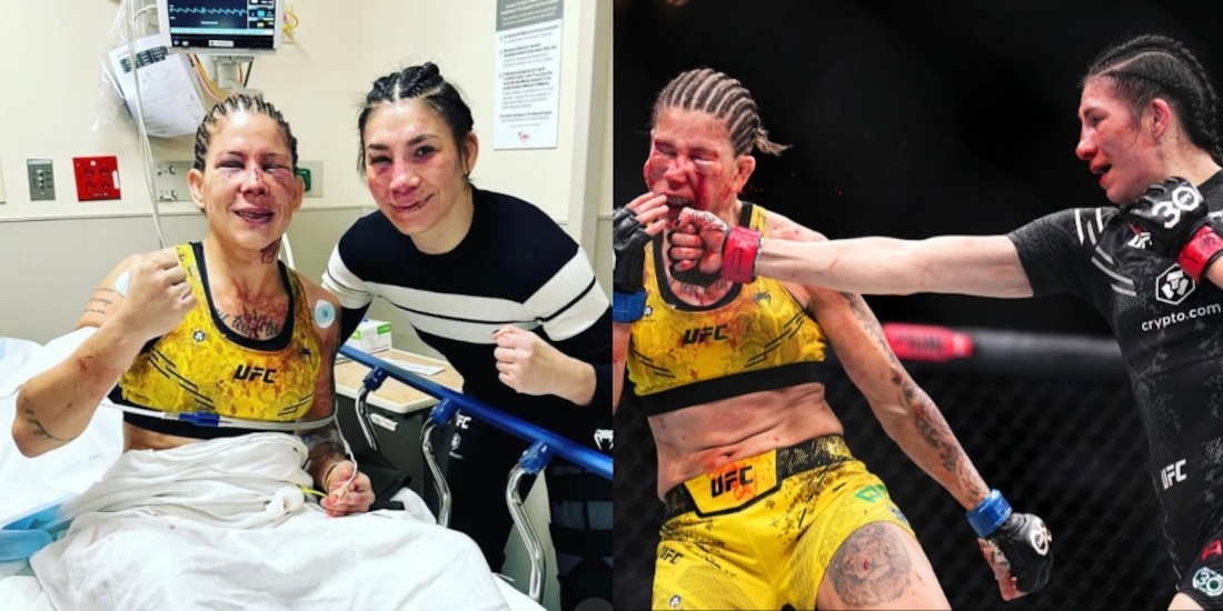 Irene Aldana y Karol Rosa tras su pelea en UFC 296