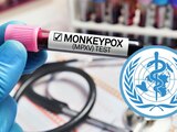 Este es el anuncio que hará la OMS sobre el mpox.