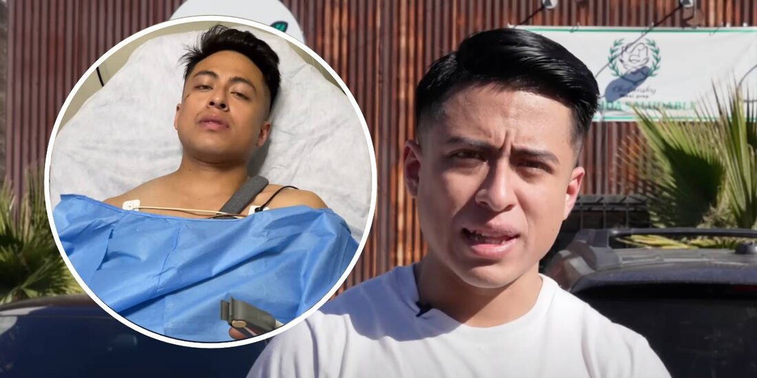 Alex Minero sufrió un terrible accidente