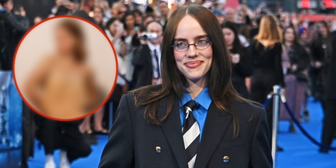 FOTO de Billie Eilish desata rumores de supuesta cirugía estética