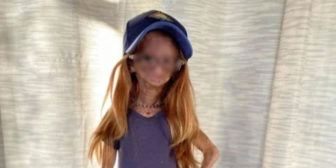 La youtuber Adalia Rose murió a los 15 años