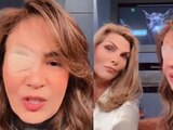 Así se ve Yolanda Andrade sin su parche en el ojo, tras su aneurisma (FOTO)