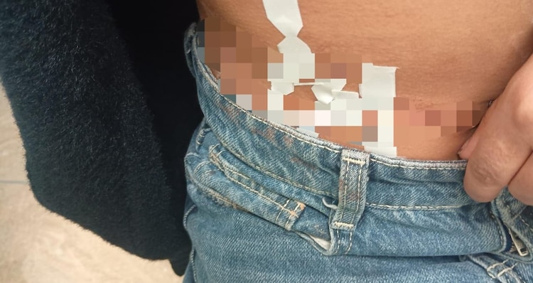 Las lesiones se atendieron primero al interior del plantel