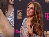 Thalía preocupa al mostrar los moretones en sus piernas ¿Le pegaron?