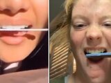 Reto viral de limarse los dientes para "emparejarlos"