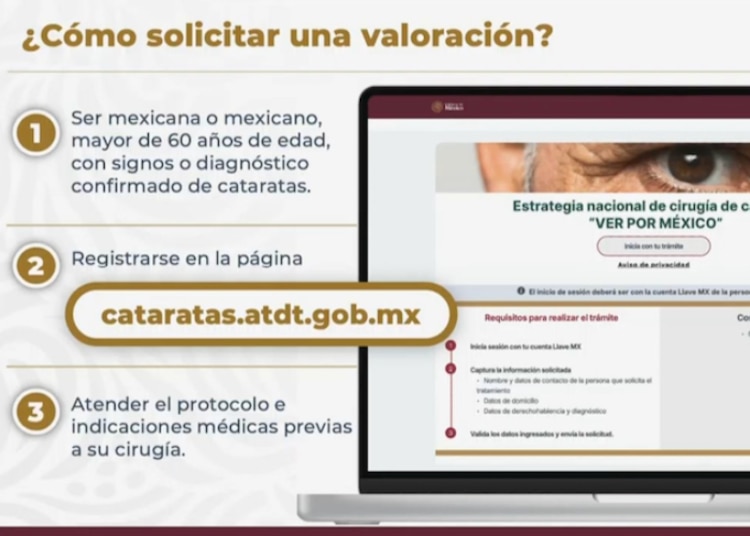 Los requisitos para las cirugías gratuitas de cataratas son sencillos de cumplir.