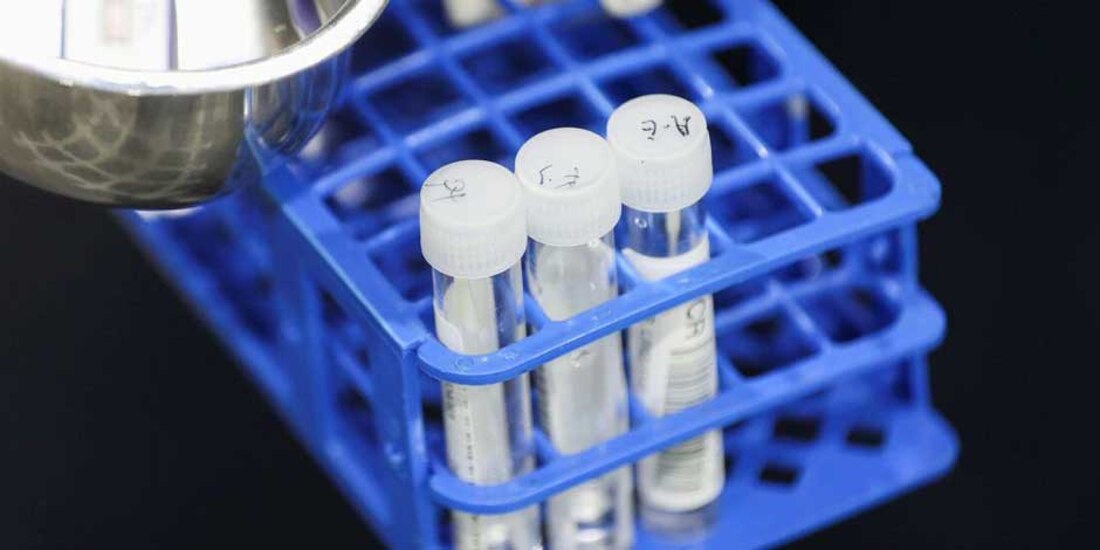 República Dominicana confirmó su primer caso de la nueva variante, Ómicron