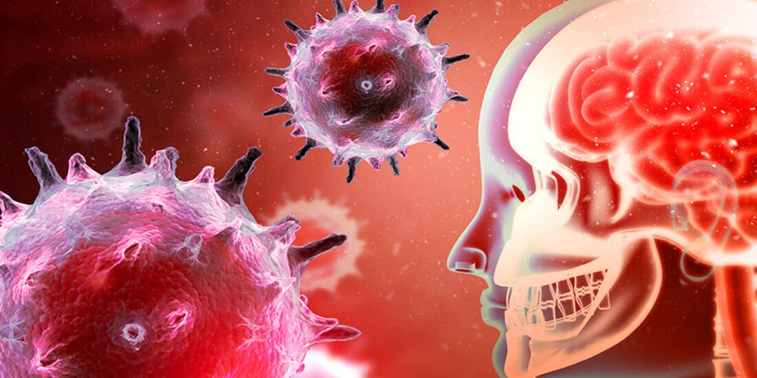 La meningitis puede ocasionar daños graves en el cerebro.