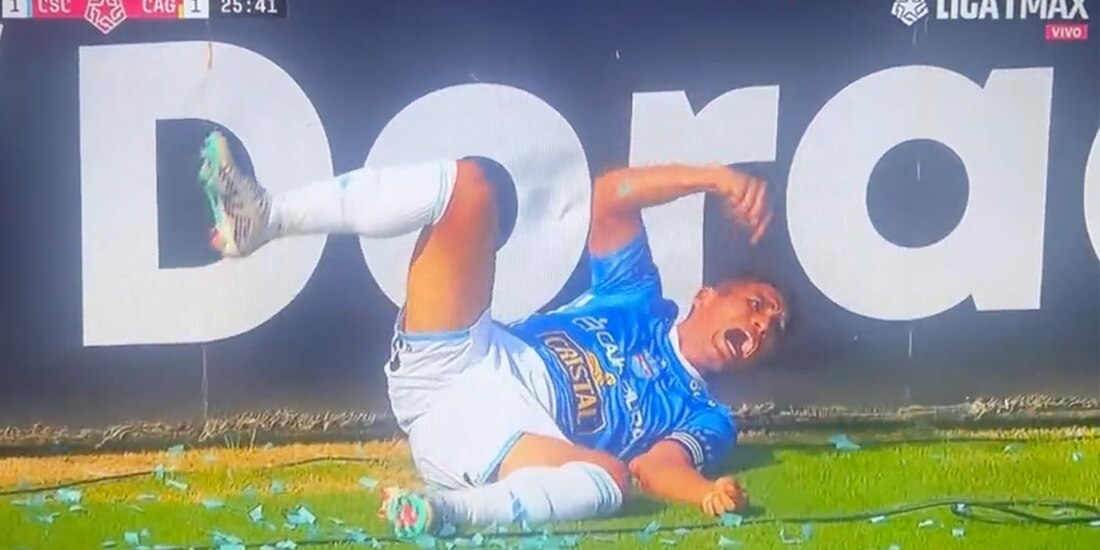 Futbolista en Perú sufre una terrible lesión.