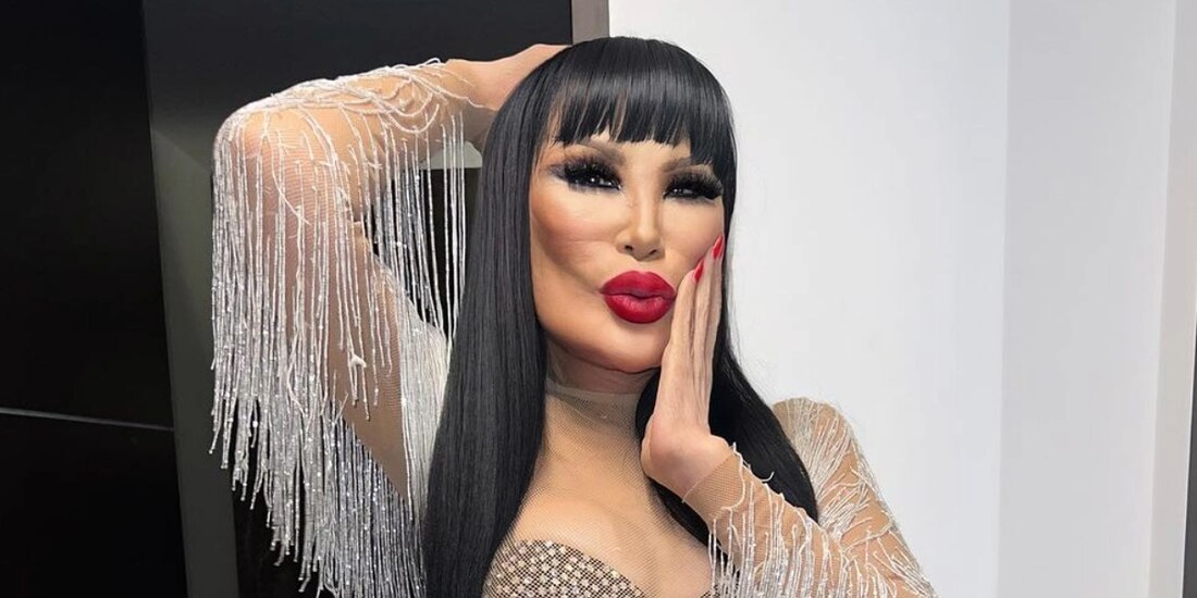 Lyn May pensó en quitarse la vida por su rostro.