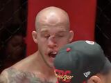 La nariz de Blake Perry durante su pelea en A1 Combat Series que pasan por UFC Fight Pass