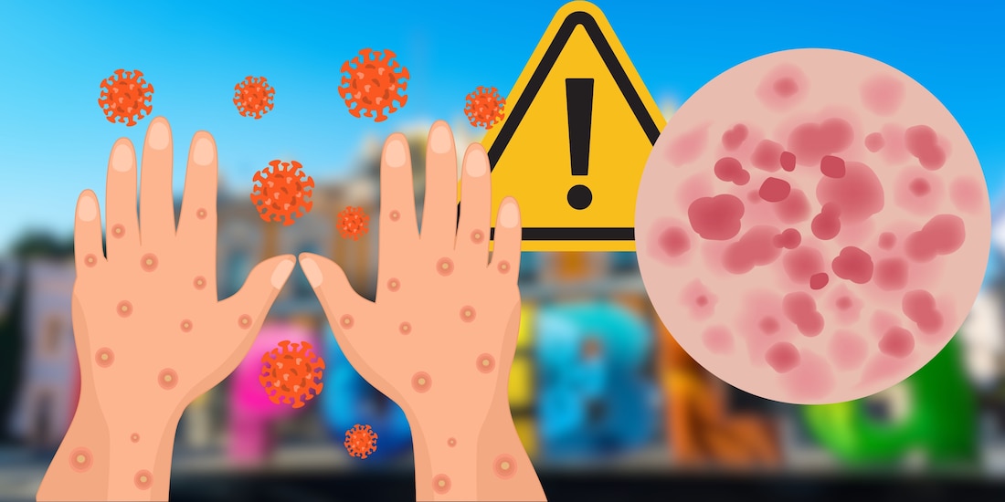 Estado de México activa medidas sanitarias