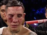 El rostro de Óscar Valdez luego de la pelea ante Emanuel 'Vaquero' Navarrete