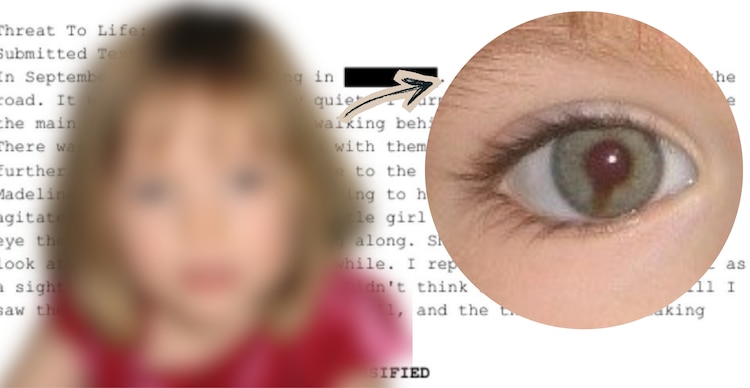 Condición ocular de Madeline McCan