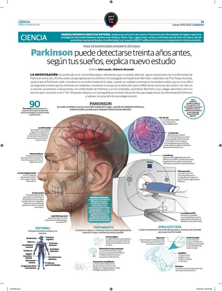 Parkinson