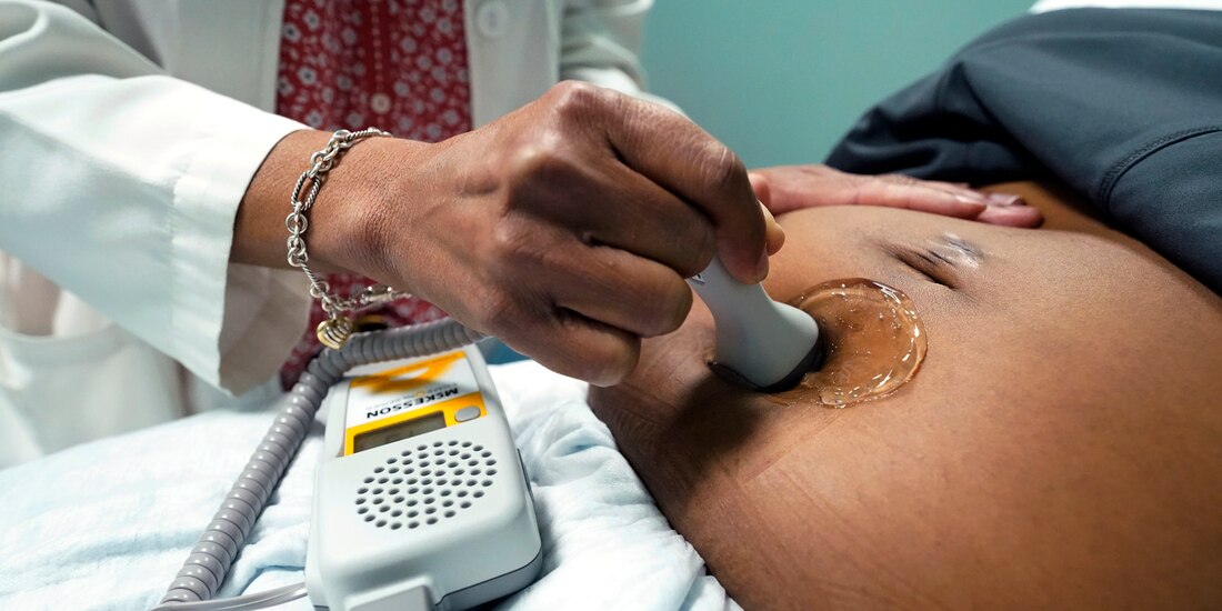 Un doctor usa una sonda manual Doppler para medir el latido de un feto, en Jackson, Mississippi)
