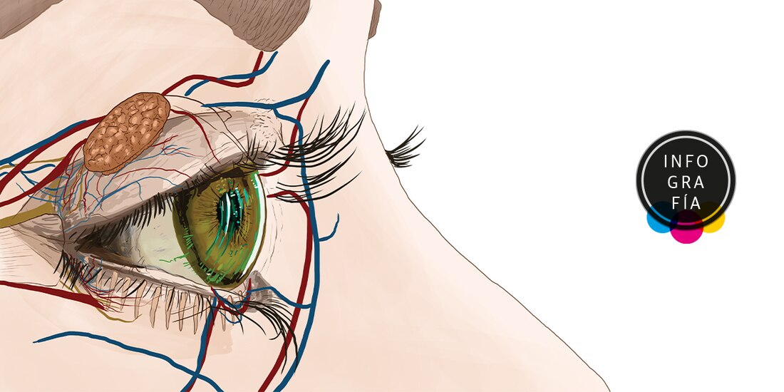 ¿Síndrome del ojo seco? Lo padecen tres de cada 10 personas en el mundo
