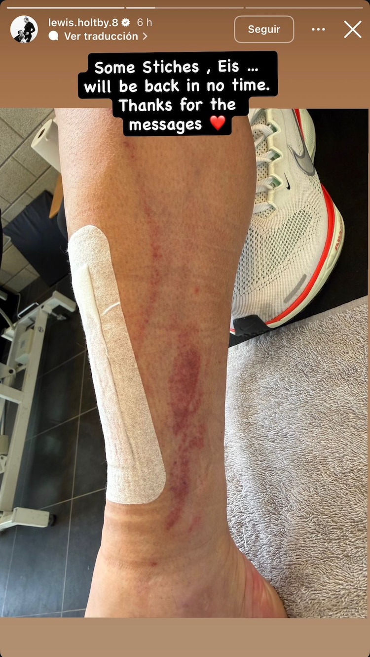 Lewis Holtby manda mensaje tras su lesión.