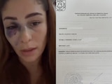 Daniela López Mejía, exseleccionada de lucha recibe brutal golpiza por parte de su pareja