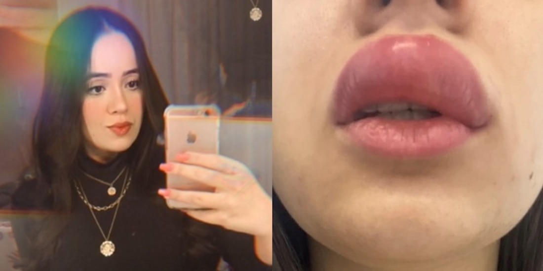 Así estaba el rostro de la joven tras el ataque del ciempiés