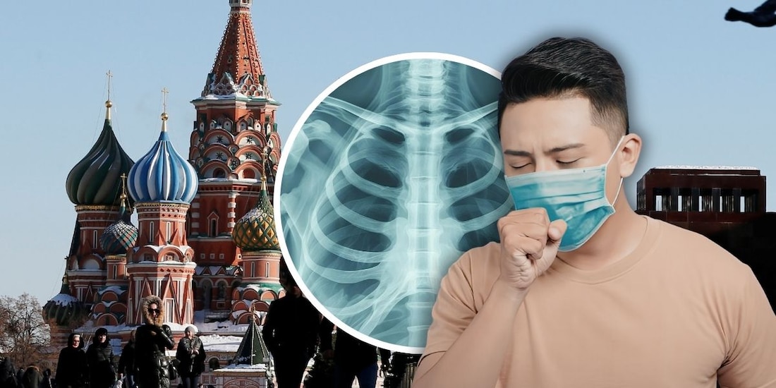 ¿Qué sabemos y cuáles son los SÍNTOMAS de la peste pulmonar rusa?