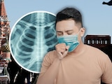 ¿Qué sabemos y cuáles son los SÍNTOMAS de la peste pulmonar rusa?