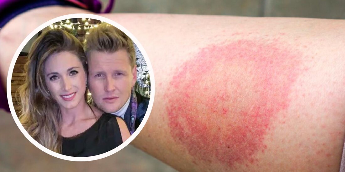 María Rojo de la Vega y Alexander Acha compartieron lo complicado que fue su tratamiento.