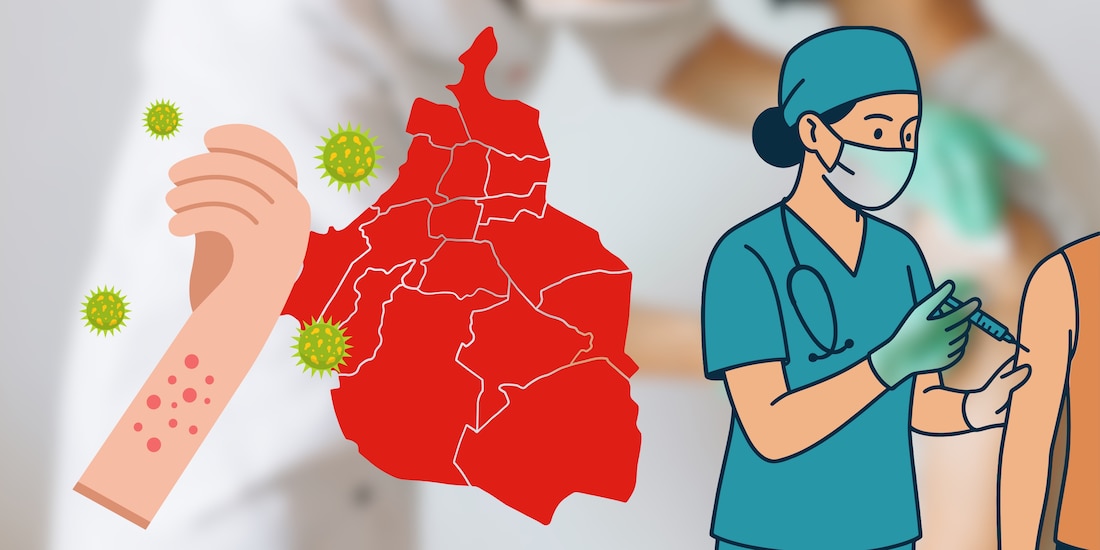 Vacuna contra sarampión CDMX