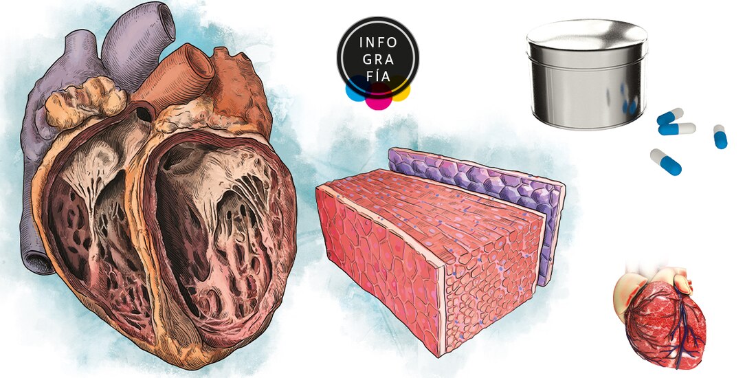 Enfermarse de Covid de forma leve dispara 72 por ciento el riesgo de sufrir una insuficiencia cardiaca
