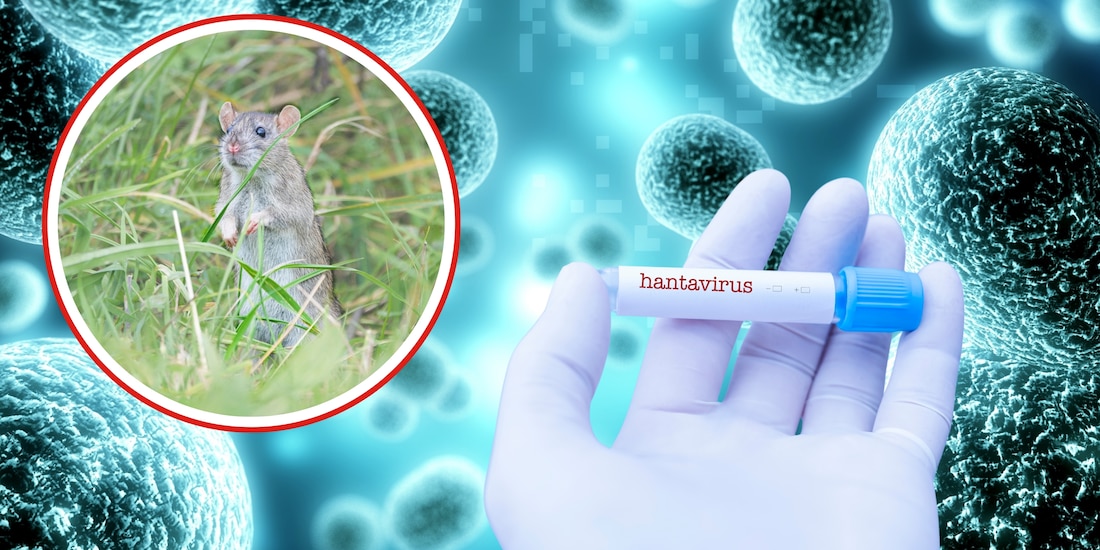 Hantavirus