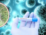 Hantavirus