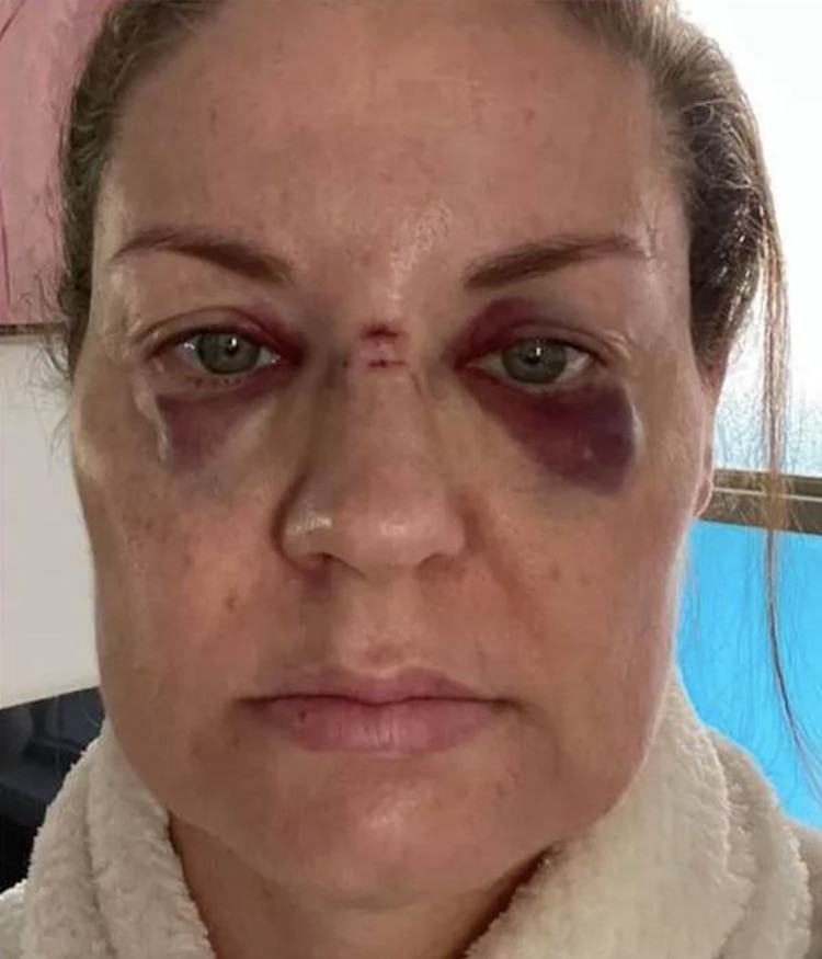 La fan golpeada por el micrófono