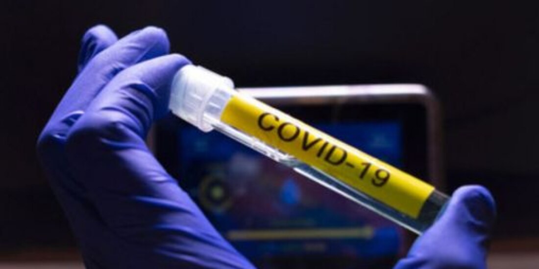  Vacunas contra el COVID-19.