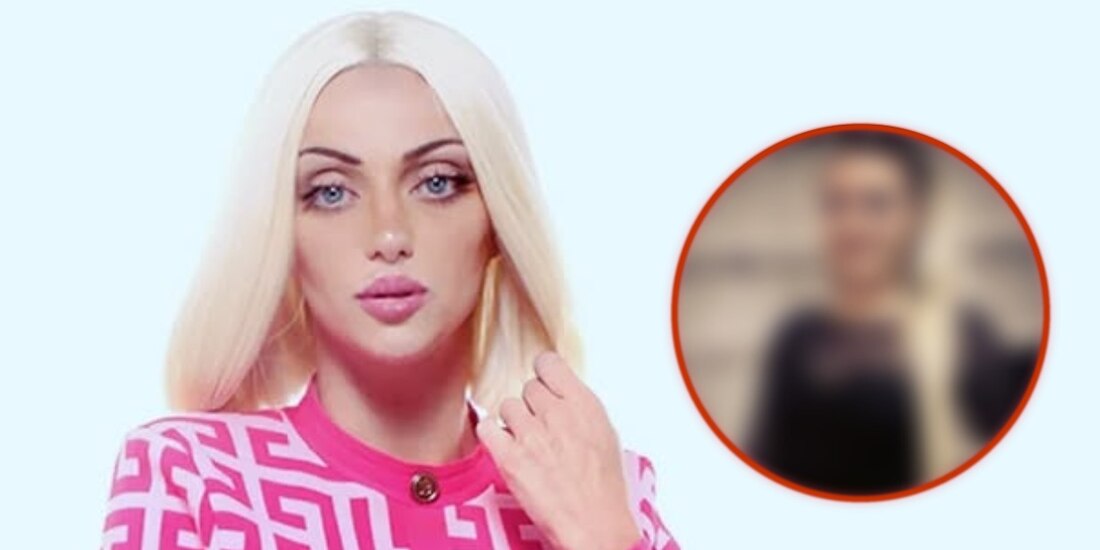 El antes y después de Bárbara Jankavski, la ‘Barbie humana’