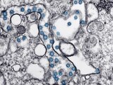 Partículas del virus SARS-CoV-2, coloreadas en azul, en una imagen de microscopio de electrones.