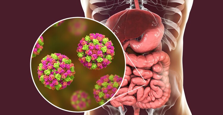 El norovirus causa fuertes infecciones estomacales