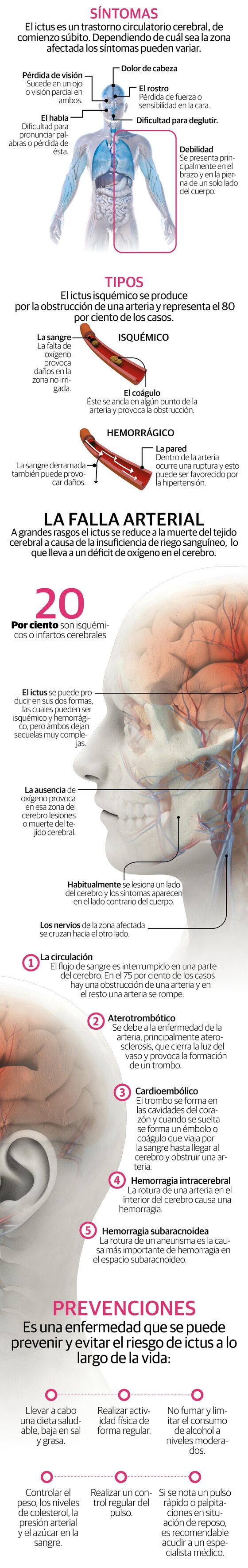 El riesgo de sufrir un accidente cerebrovascular por exceso de horas ante el ordenador o TV