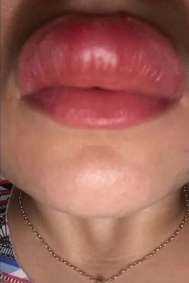 La joven tuvo miedo de morir al ver el enorme ciempiés