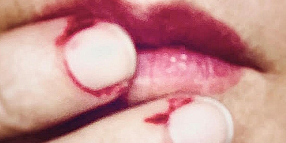 Piel de cinco estrellas