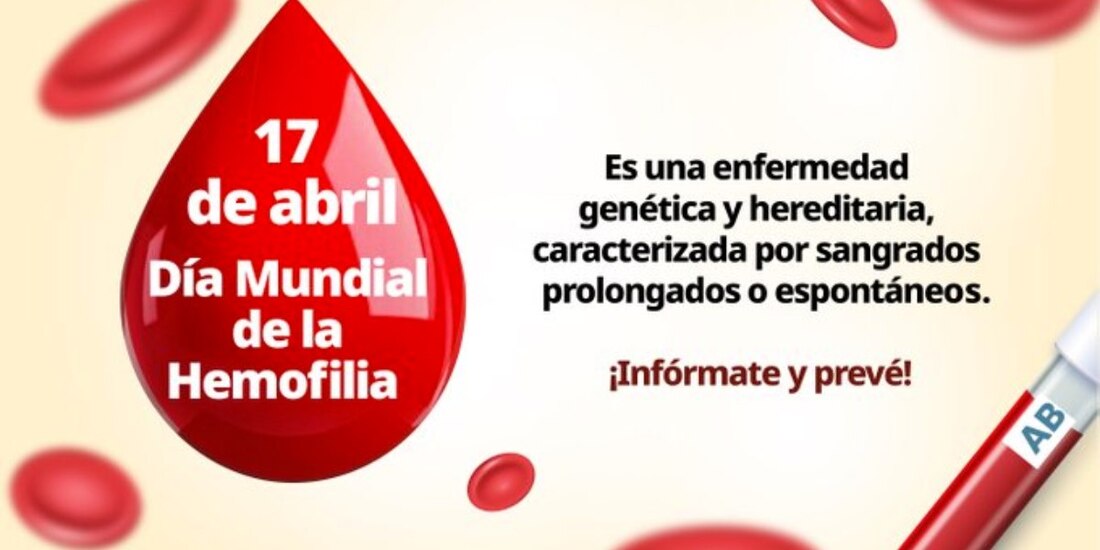 Con diagnóstico, tratamiento y atención a emergencias, ISSSTE mejora calidad de vida de pacientes con hemofilia.