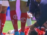 Marcel Ruiz yace en el césped después del fuerte golpe de cabeza que sufrió con Joaquín Montecinos durante el partido entre Toluca y Tijuana.
