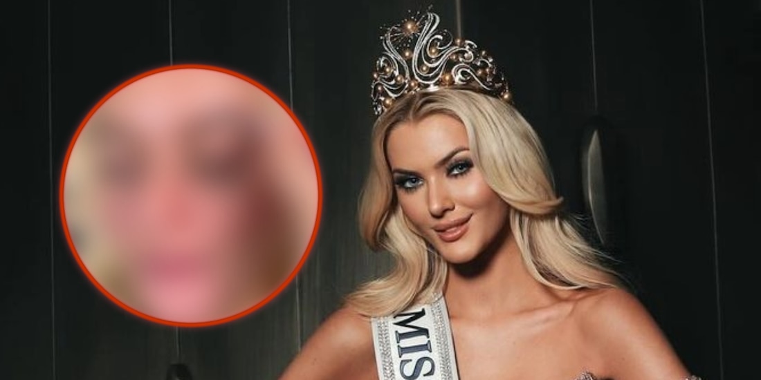 Así luce Victoria Kjaer, Miss Universo 2024, sin maquillaje.