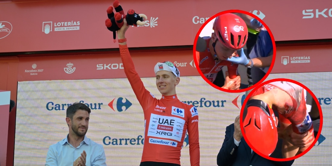 Tadej Pogačar se retira de la Vuelta a España tras caer durante la etapa 8