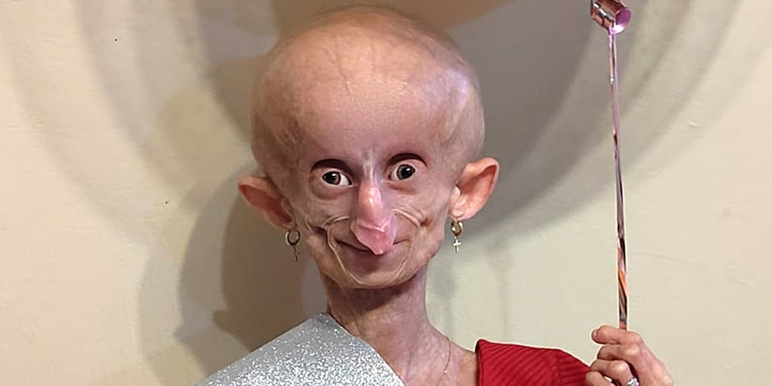 ¿Quién era Beandri Booysen, influencer que murió a los 19 años, tras una extraña enfermedad?