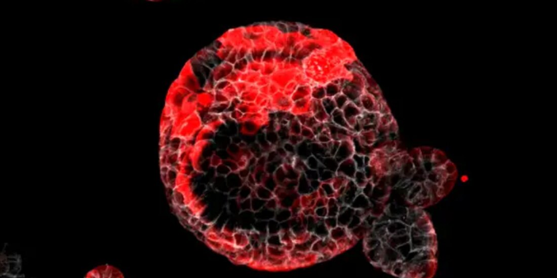 Tamiz neonatal ayuda a prevenir cáncer, señalan