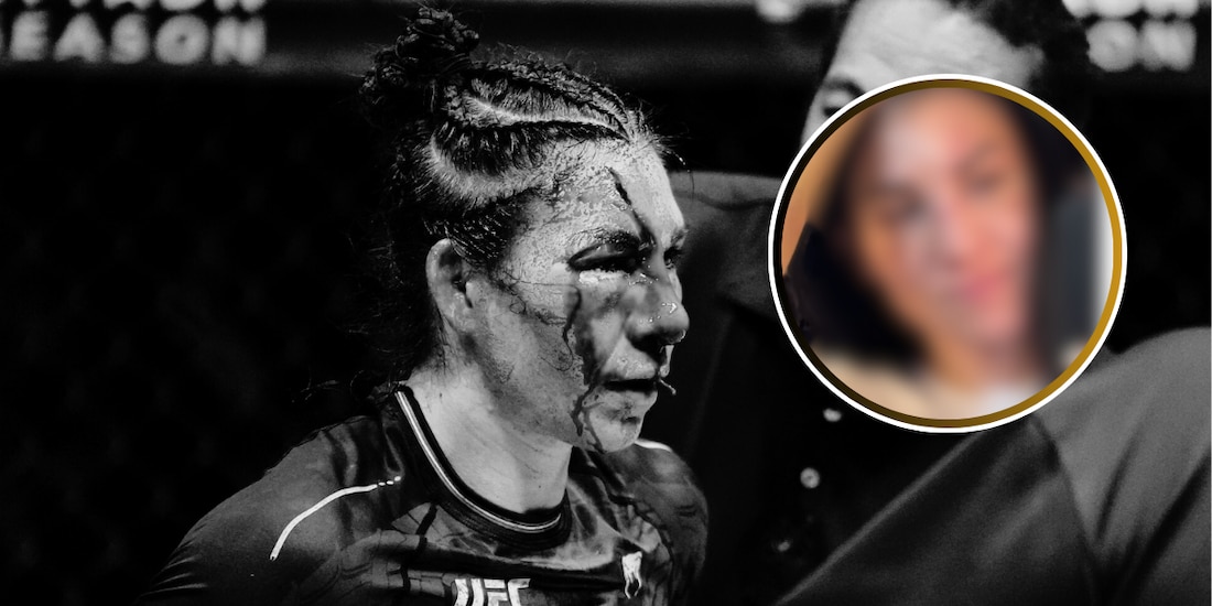 Irene Aldana muestra su rostro después de su recuperación