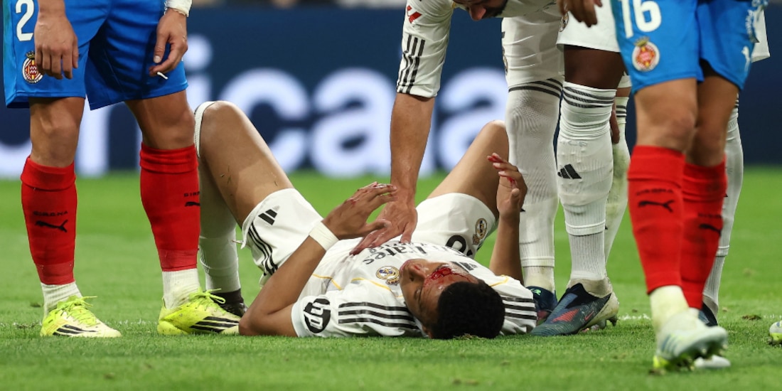 Kylian Mbappé quedó ensangrentado en la cancha del Santiago Bernabéu.