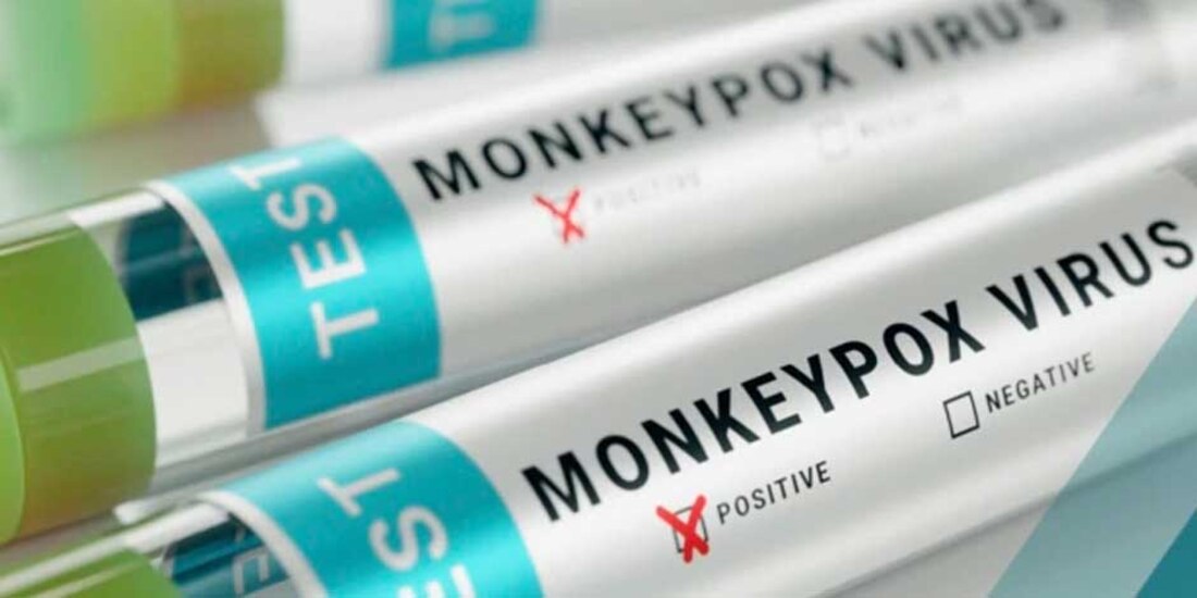 El predominio de los casos ya confirmados se recarga en los hombres.