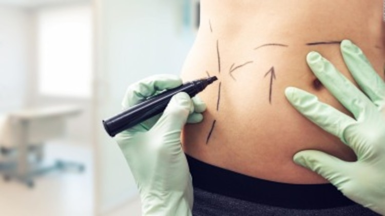 Procedimientos estéticos