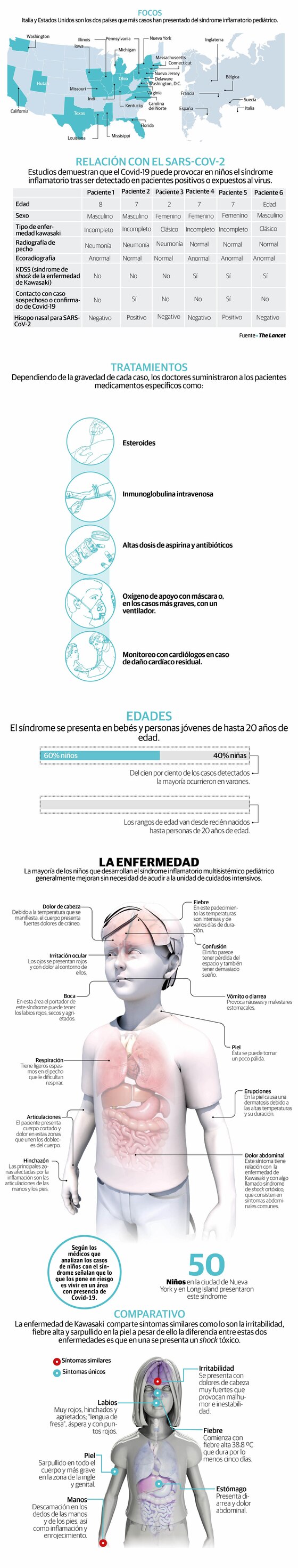 El síndrome pediátrico relacionado con Covid-19
